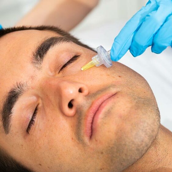 carboxiterapia, grasa localizada, grasa, tratamiento, piel, tratamiento, piel, celulitis, grasa, corporal, rejuvenecimiento, oxígeno, inyección, estética, circulación, colágeno, elasticidad, reducción, arrugas, terapia, belleza, médico, subcutáneo, técnica, salud, sesión, resultados, beneficios, procedimiento, efectos secundarios, área, número, experiencia, enfermedades, problemas, aplicaciones, liposucción, flujo, elasticidad, cantidad, general, vasodilatación, gracias, envejecimiento, efectos, eliminación, firmeza, técnicas, producción, tono, mujeres, Carboxiterapia, ojeras, Barcelona, carboxiterapia, grasa localizada, grasa, tratamiento, piel, tratamiento, piel, celulitis, grasa, corporal, rejuvenecimiento, oxígeno, inyección, estética, circulación, colágeno, elasticidad, reducción, arrugas, terapia, belleza, médico, subcutáneo, técnica, salud, sesión, resultados, beneficios, procedimiento, efectos secundarios, área, número, experiencia, enfermedades, problemas, aplicaciones, liposucción, flujo, elasticidad, cantidad, general, vasodilatación, gracias, envejecimiento, efectos, eliminación, firmeza, técnicas, producción, tono, mujeres, .