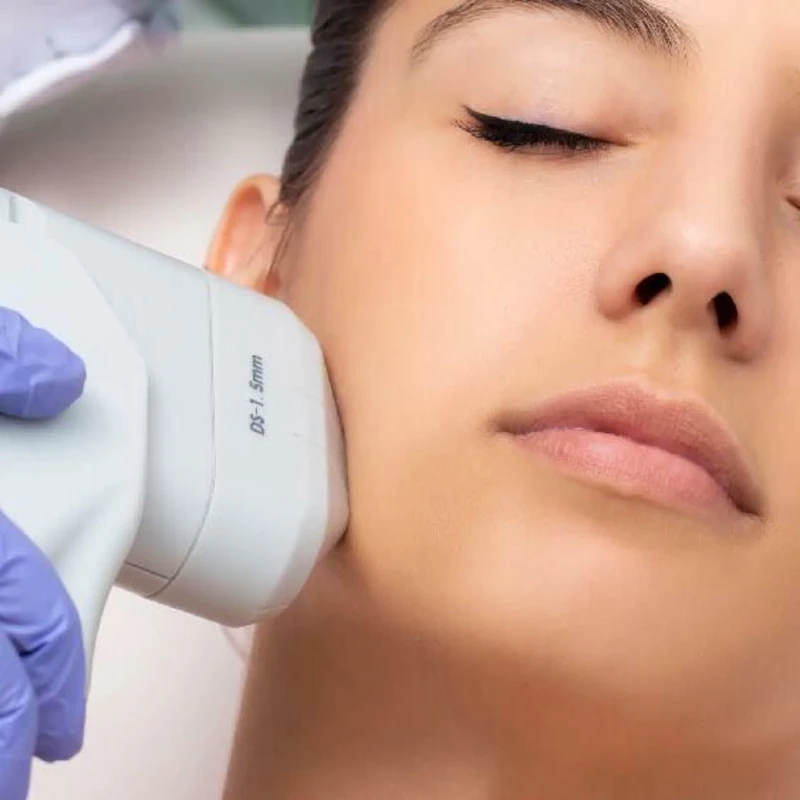 hifu-facial-dra-blanco-barcelona-01