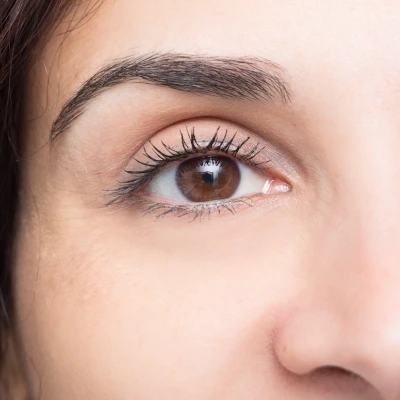 blefaroplastia-dra-blanco-barcelona