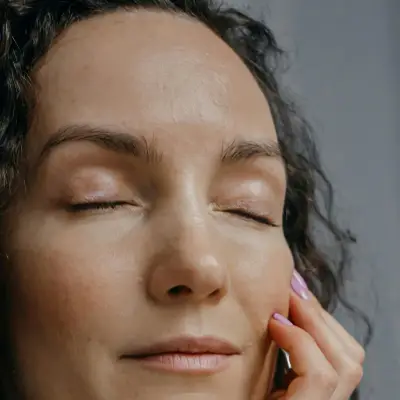 acido-hialuronico-ojeras-Doctora-Blanco-Medicina-Estetica-Barcelona-3 Eliminar ojeras con ácido hialurónico en Barcelona