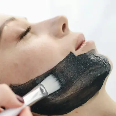 carbon-laser-peel-Doctora-Blanco-Medicina-Estetica-Barcelona