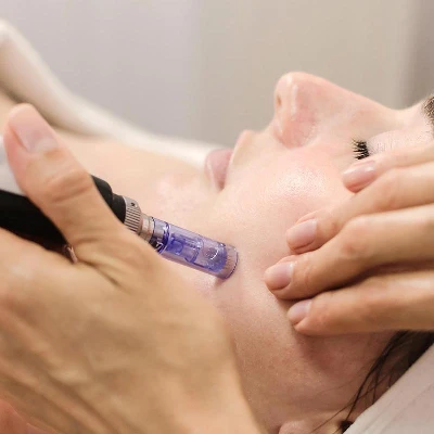 Dermapen-Doctora-Blanco